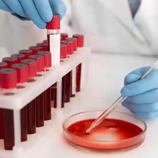 CMV (Cytomegalovirus) Quantitative PCR Test